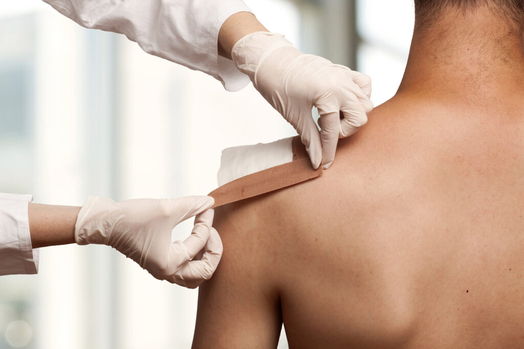 The Shoulder joint in Sports