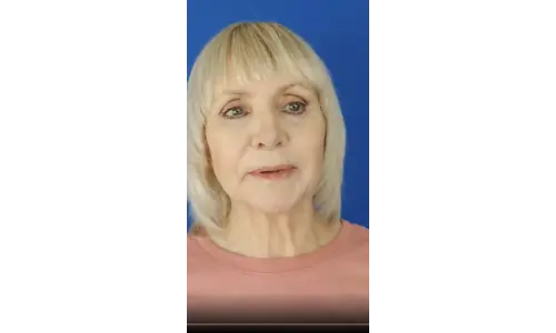 Physiotherapy Vancouver